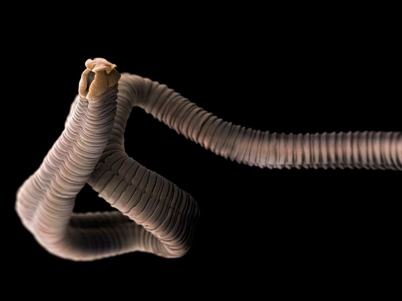 A Tapeworm